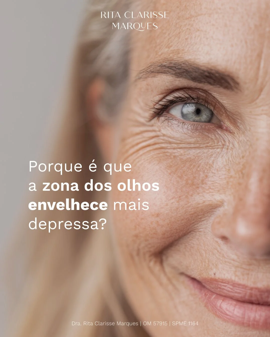 A zona dos olhos &eacute; uma das primeiras a revelar sinais de idade, n&atilde;o por acaso, mas pela sua estrutura fr&aacute;gil e pela intensidade dos movimentos di&aacute;rios.

Com pequenos cuidados e tratamentos adequados, &eacute; poss&iacute;v