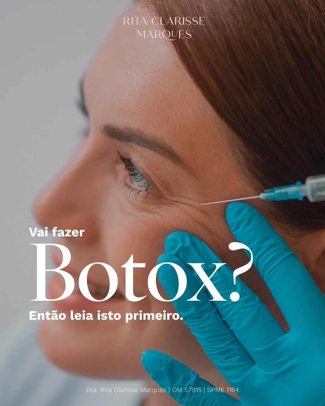 Se est&aacute; a pensar fazer em aplicar Toxina Botul&iacute;nica (conhecido como Botox), reuni aqui alguns cuidados importantes para garantir um resultado seguro e eficaz.

Pequenos gestos nos dias anteriores fazem toda a diferen&ccedil;a no procedi