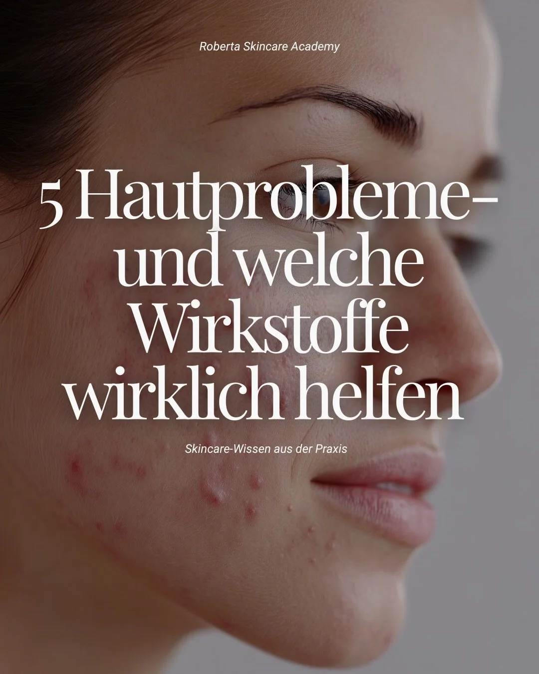 Die Haut zu verstehen bedeutet, die richtigen Wirkstoffe zu kennen.

Viele Behandlungen scheitern nicht an der Technik, sondern an der falschen Produktwahl.

In der Roberta Skin Academy lernst du, Hautprobleme zu analysieren und gezielt zu behandeln.