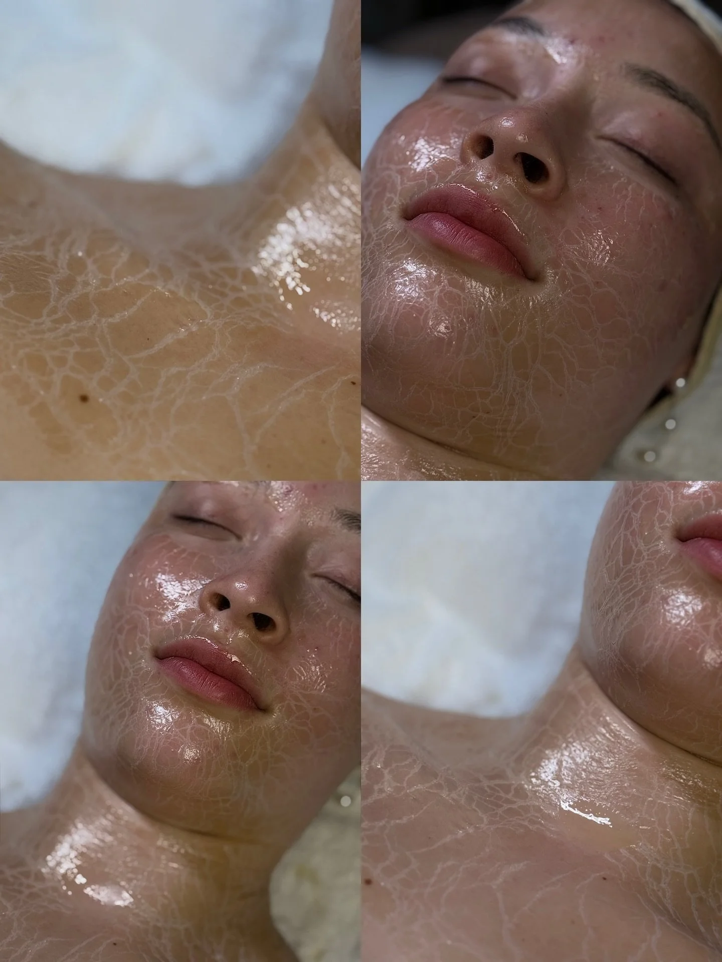 Ein wichtiger Bestandteil einer professionellen Behandlung:
die richtige Maske &ndash; zur richtigen Zeit.

In dieser Behandlung arbeiten wir mit der Circadia Firming Peptide Mask,
einer festigenden und straffenden Maske,
die gezielt auf Elastizit&au