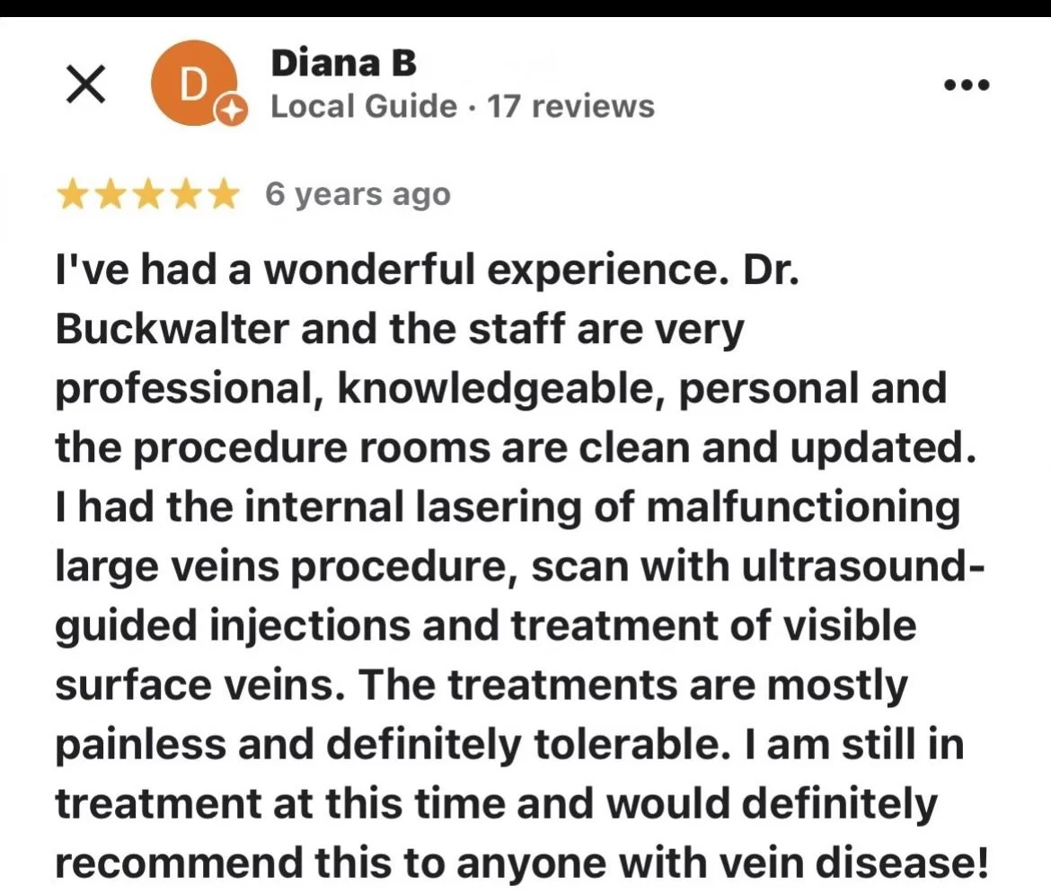 Five-star patient review, describing positive experience with the doctor's care and professionalism in the treatment of varicose veins.