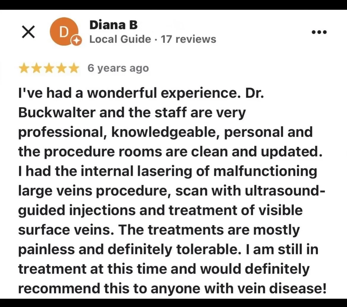 Five-star patient review, describing positive experience with the doctor's care and professionalism in the treatment of varicose veins.