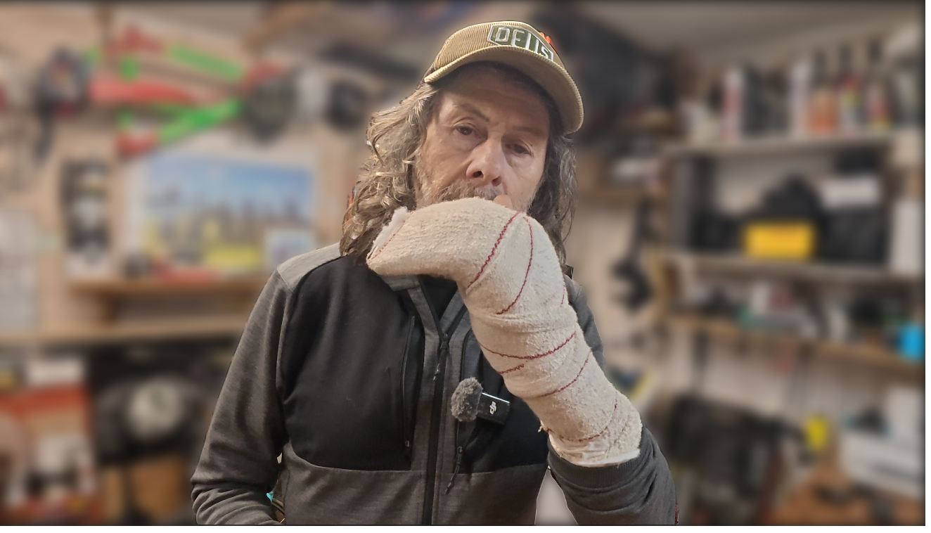 Snapped Tendon and more