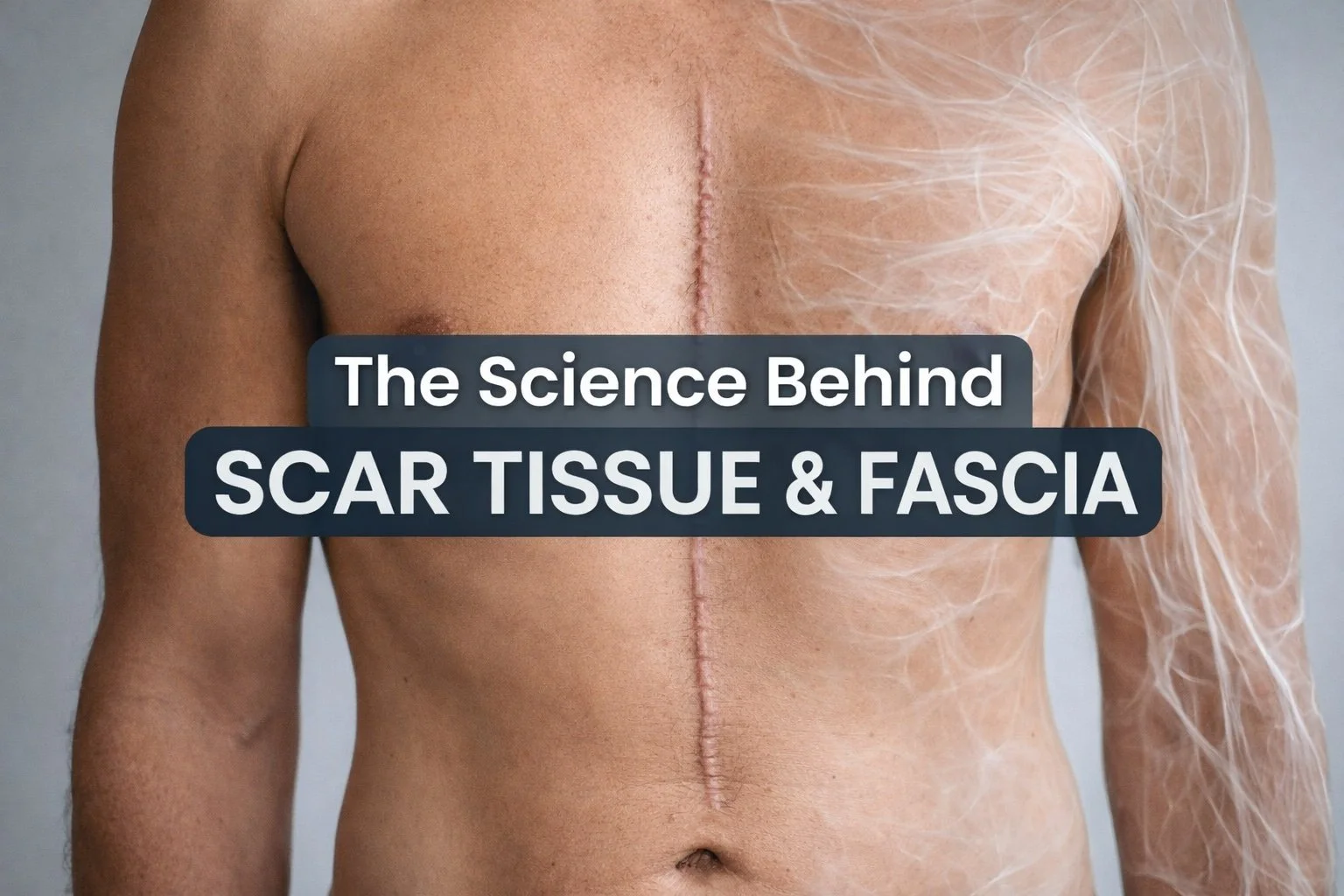How Scar Tissue and Fascia Contribute to Whole-Body Pain