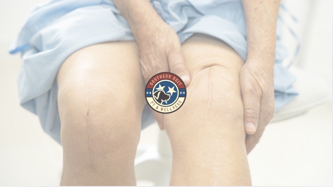 Total Knee Replacement Checklist