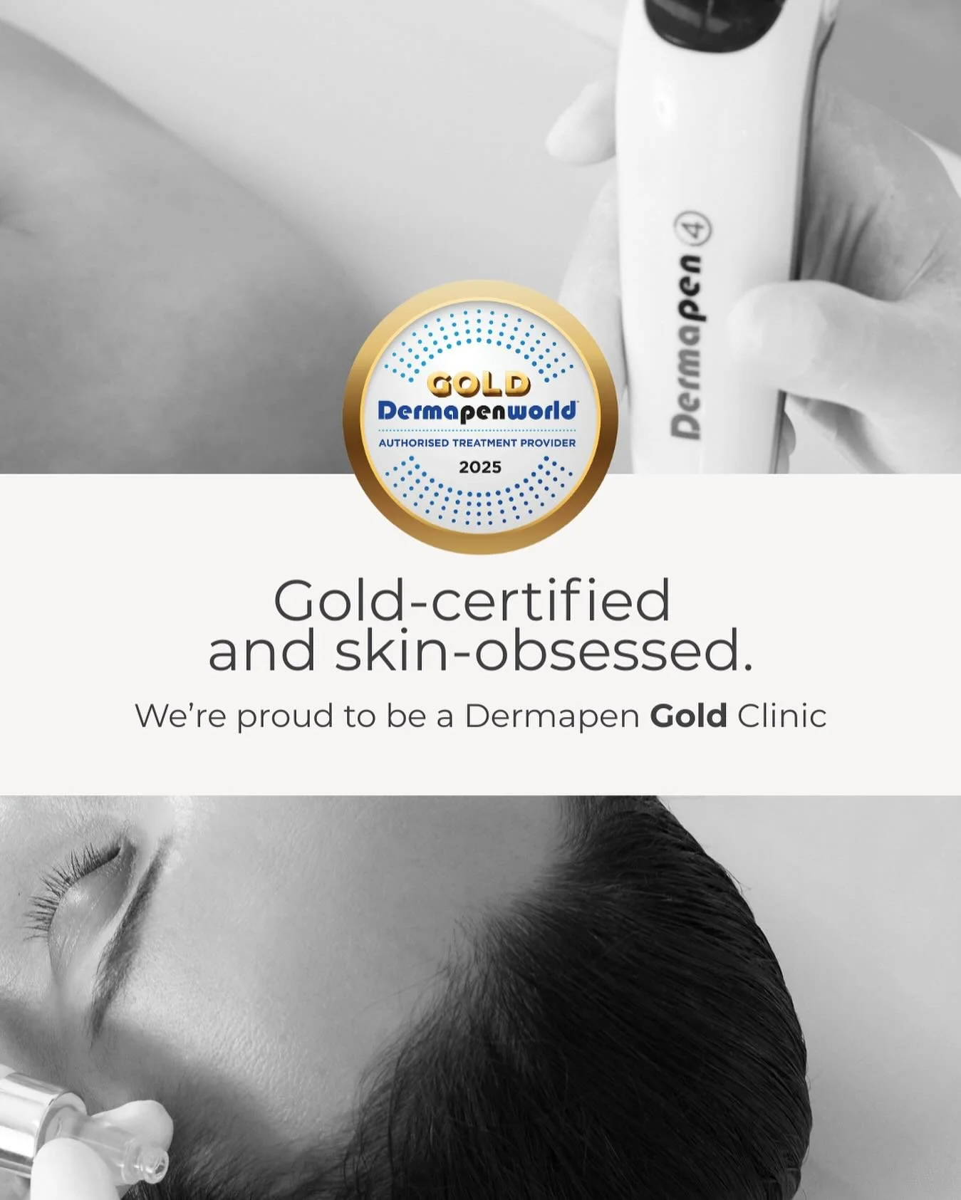 ✨ Want the best microneedling results? Go for GOLD ✨ 
At Authentic Skin &amp; Beauty, we&rsquo;re proud to be a Dermapen Gold Authorised Clinic &ndash; meaning we use the advanced Dermapen4 device with precision micro-needles to stimulate collagen an