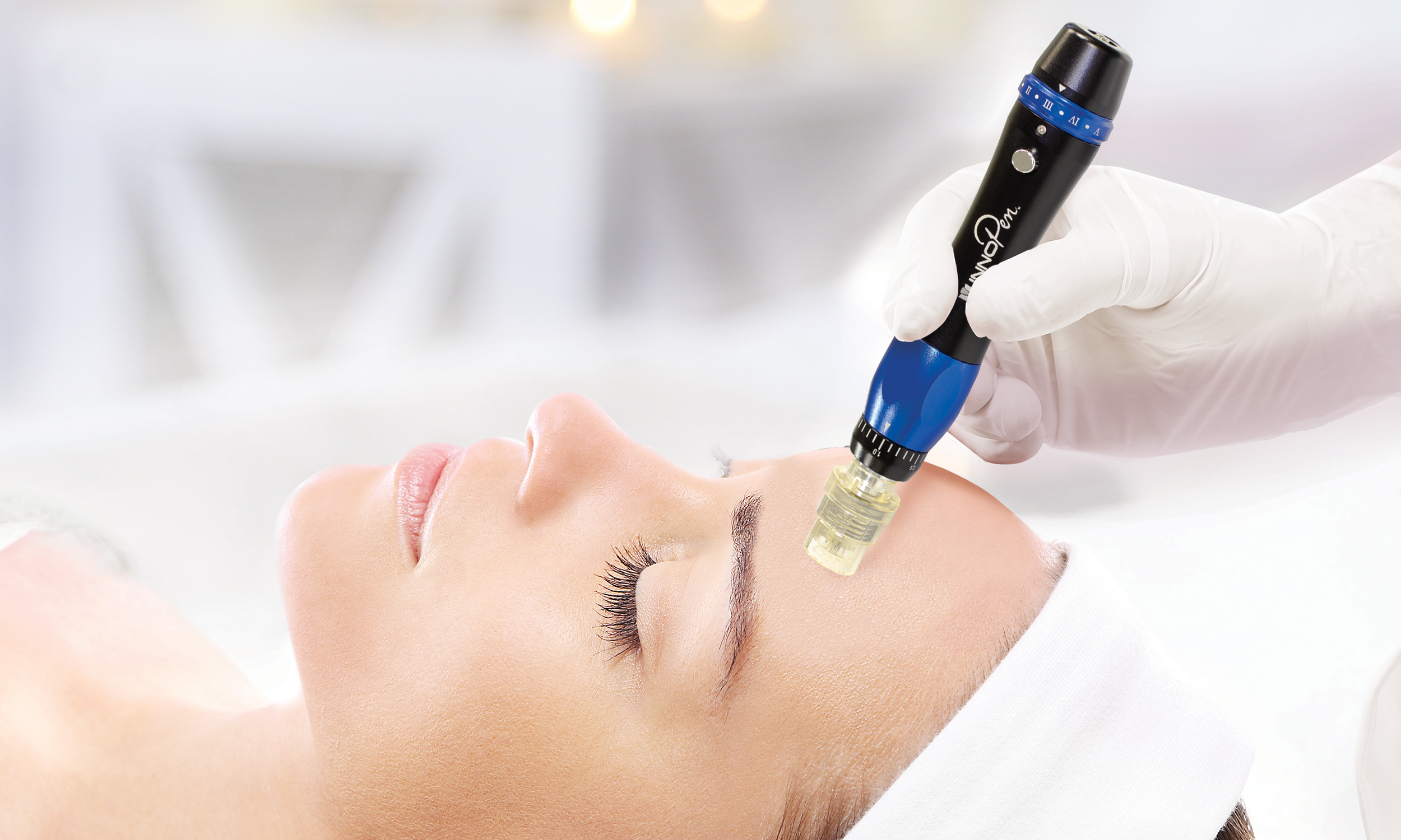 Microneedling