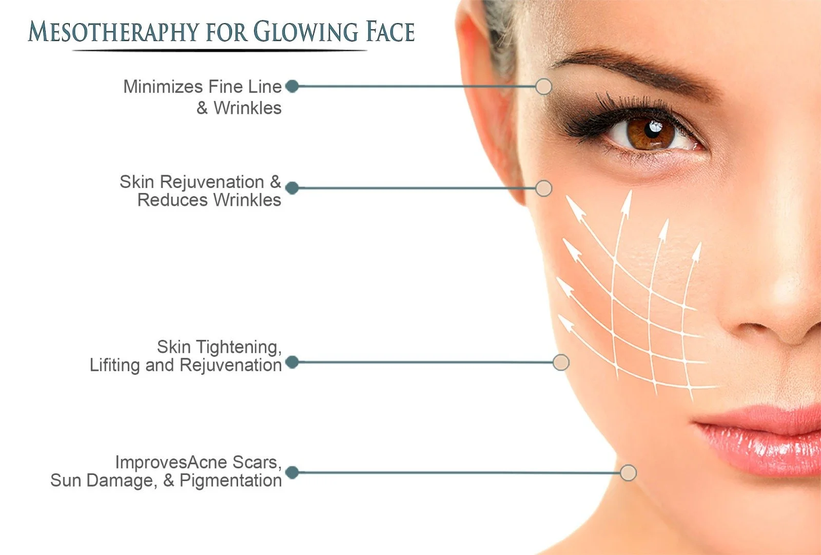 mesotherapy for face