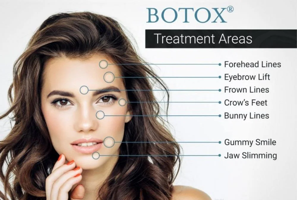 botox treatment areas