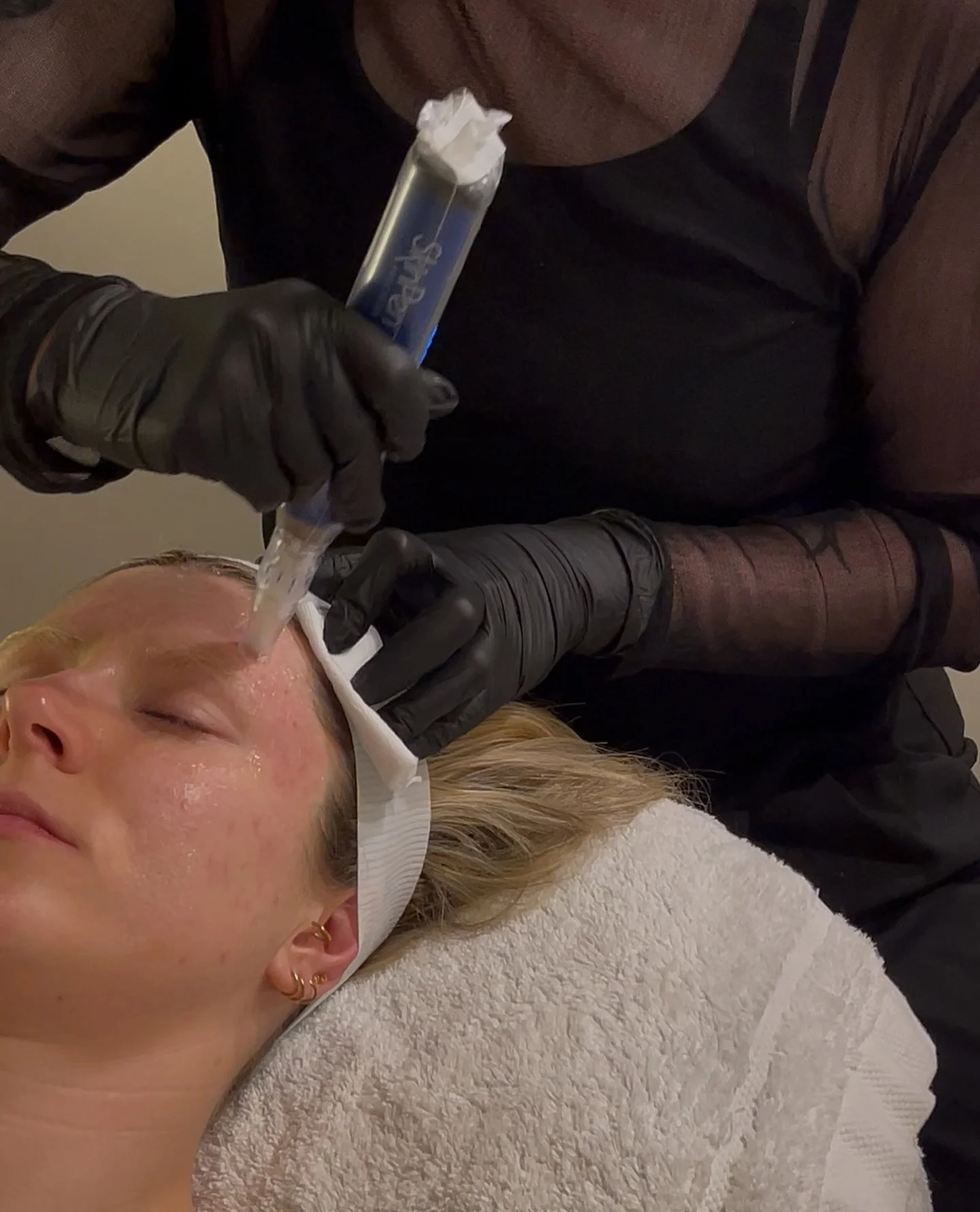 SKIN NEEDLING | Skin feeling textured or congested? Skin needling might be your answer! Not only does the treatment stimulate collagen and encourage cell turnover, it also helps refine pores and smooth texture.
Want to know more about skin needling?