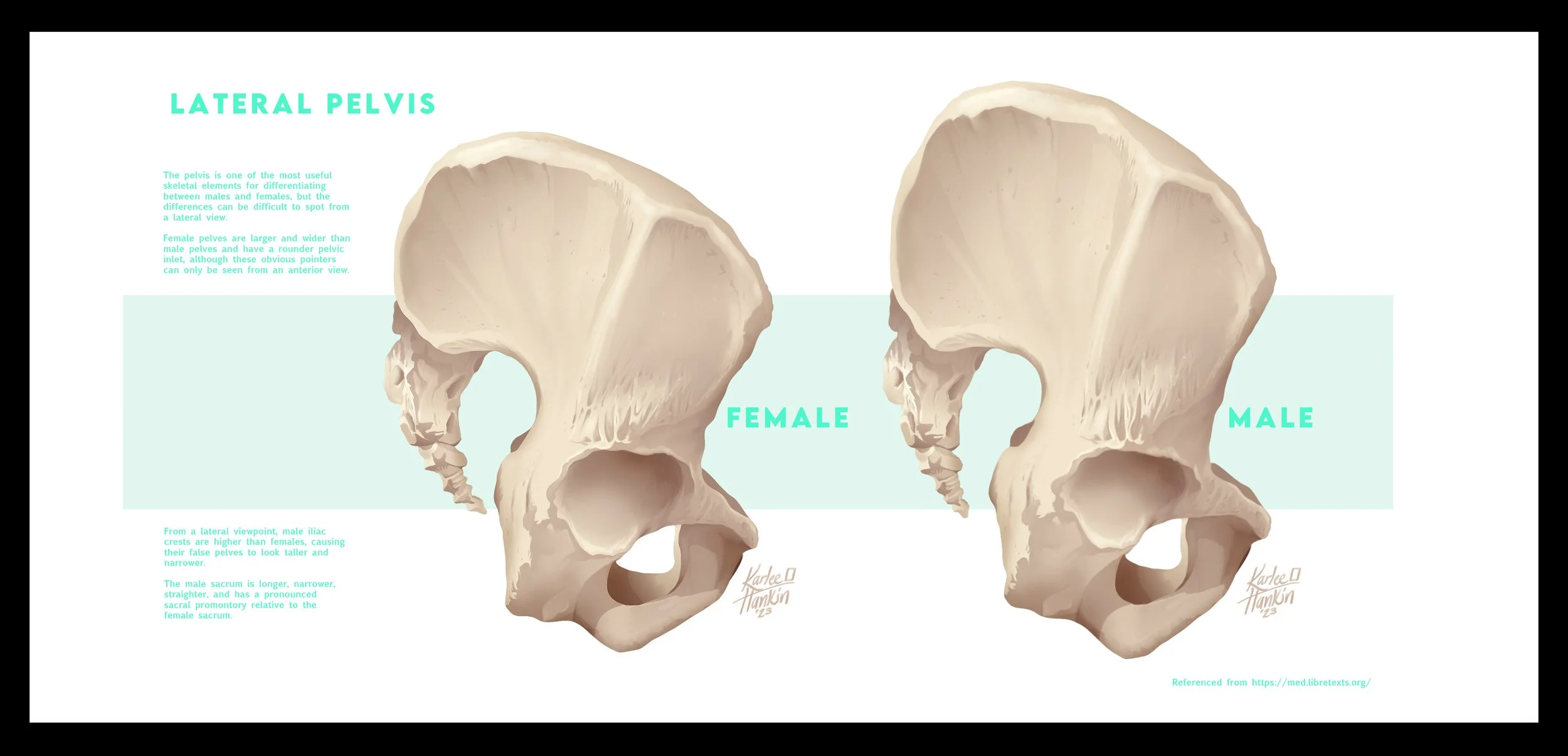 Illustration of female and male pelvis bones, highlighting differences in size and shape. The female pelvis is wider and larger, with a rounded pelvic inlet, while the male pelvis has higher iliac crests and a longer, narrower sacrum. Labels indicate