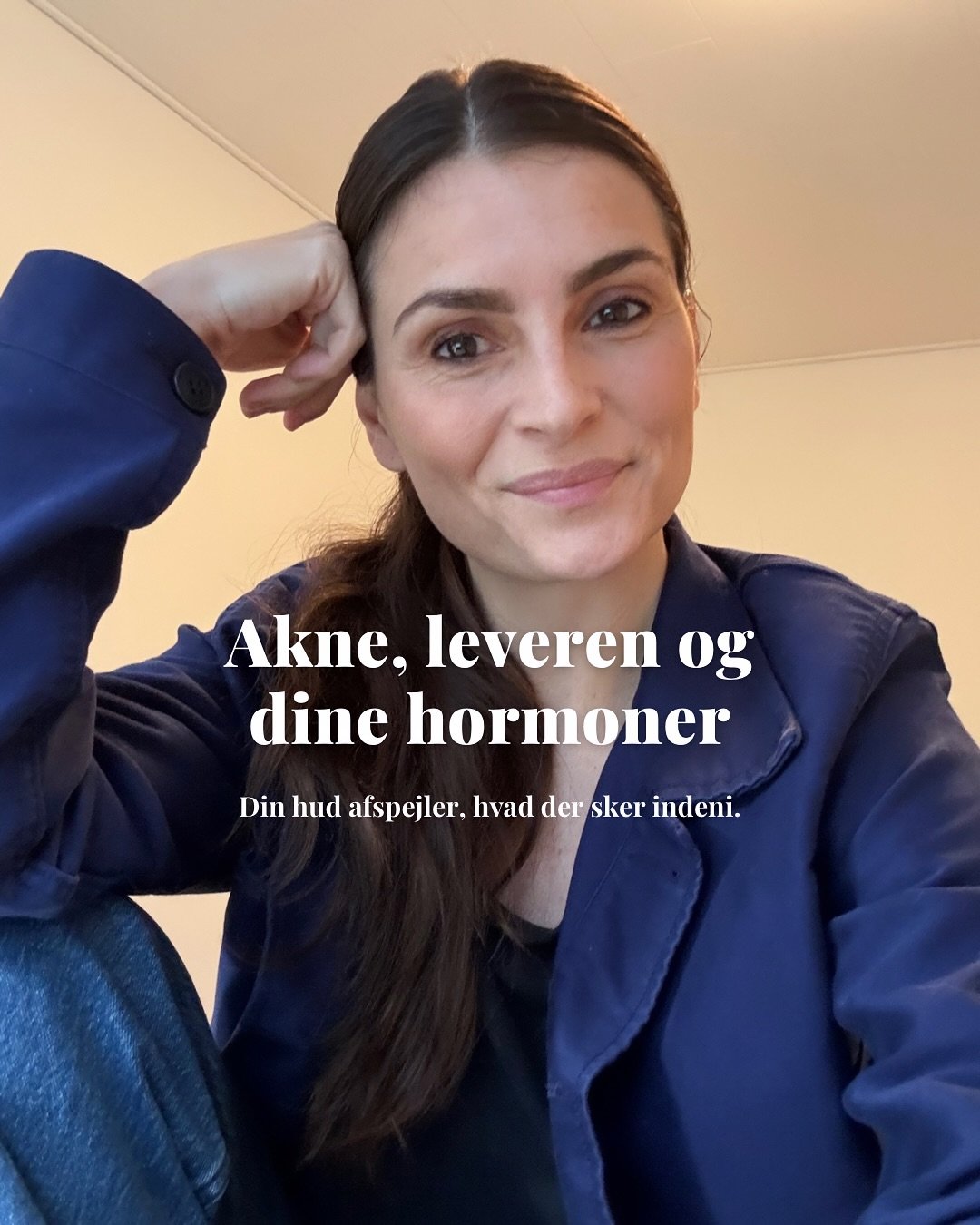 N&aring;r vi arbejder med akne, er det s&aring; vigtigt, at vi starter i kroppen!

Var du klar over, at n&aring;r din lever ikke fungerer optimalt, s&aring; kan det f&oslash;re til ophobning og affaldsstoffer, d&aring;rlig &oslash;strogen metabolisme