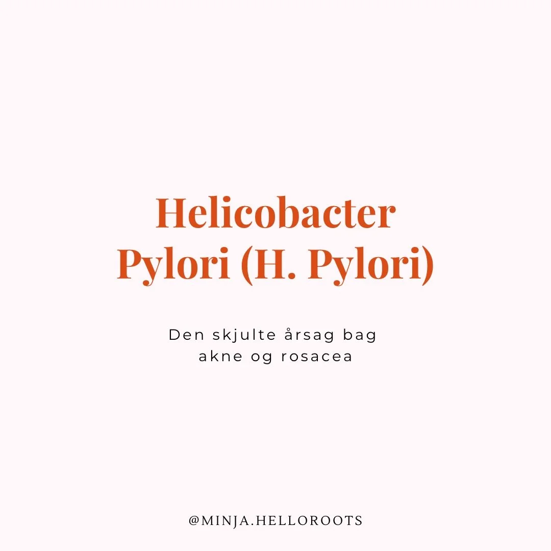 H. pylori &ndash; den oversete mavebakterie, der kan p&aring;virke b&aring;de akne og rosacea 

De f&aelig;rreste ved det&hellip;
Men huden starter faktisk i maven.

Og hos nogle mennesker kan mavebakterien H. pylori v&aelig;re med til at forst&aelig