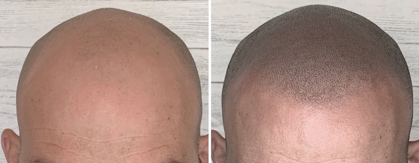 SMP before + after
