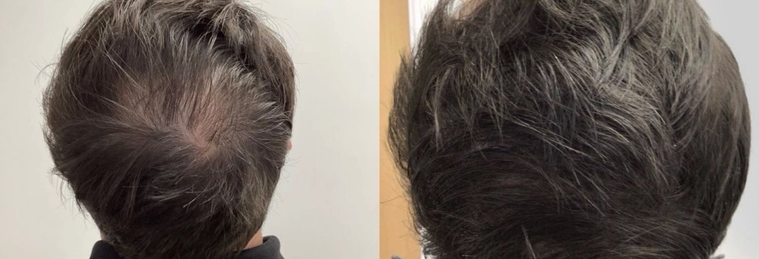 before + after treatment