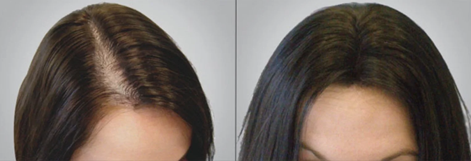 before + after treatment