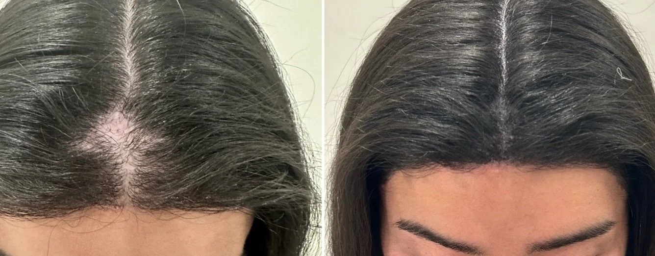 SMP before + after