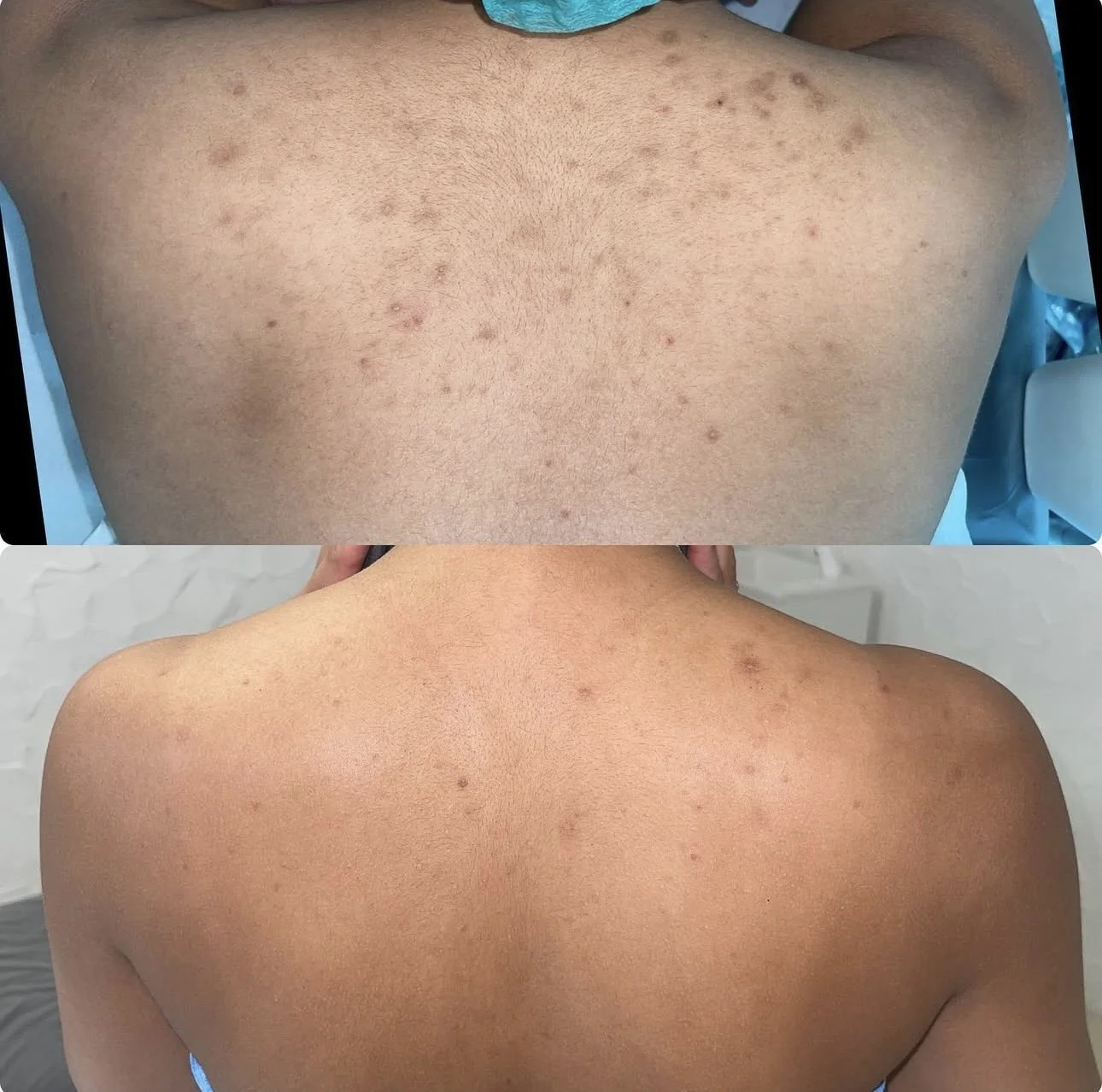 organo peel results 7.PNG