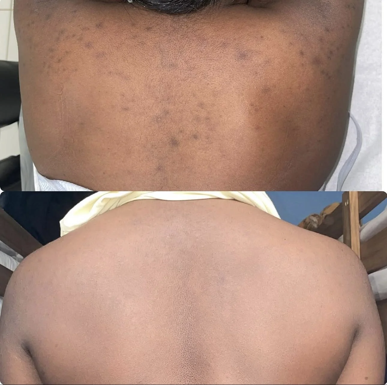 organo peel results 6 (1).PNG