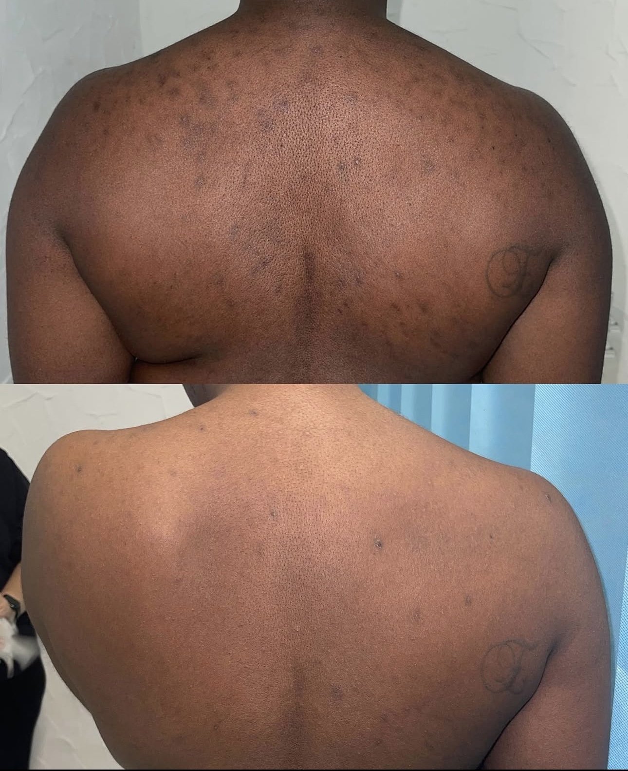 organo peel results 3 (3).PNG