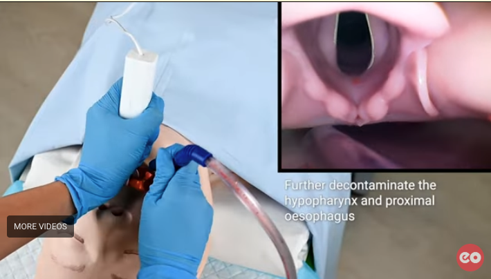 Intubating the contaminated airway