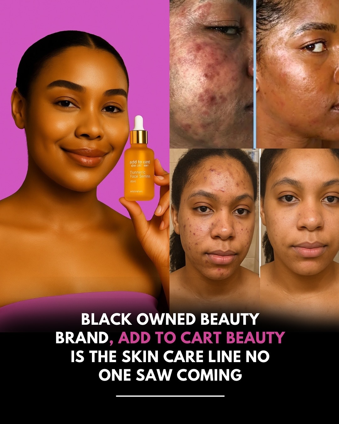 The Melanin Formula Custom-Built for Us That Fixes Skincare's Biggest Gap