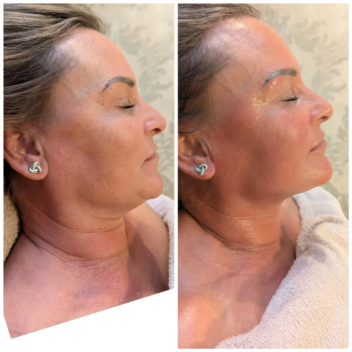 That glow 😍 That jawline 😍 

No fancy gadgets today just a truly relaxing Japanese face sculpt massage for this beautiful client 😍

It's been so Popular!  Thank you to all the models booked in so far OCTOBER IS NOW FULLY BOOKED !! ☺️

 I will now 