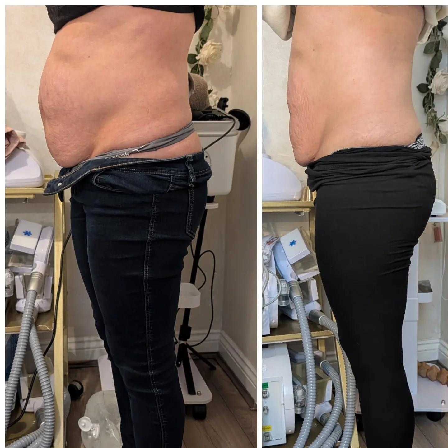 Every transformation starts with a vision&hellip;

Then comes the work.

Then comes the wow ✨

Another happy customer after trusting the process and we are not  finished yet!

Proudly transforming properties across Birmingham, Sandwell, Wolverhampton