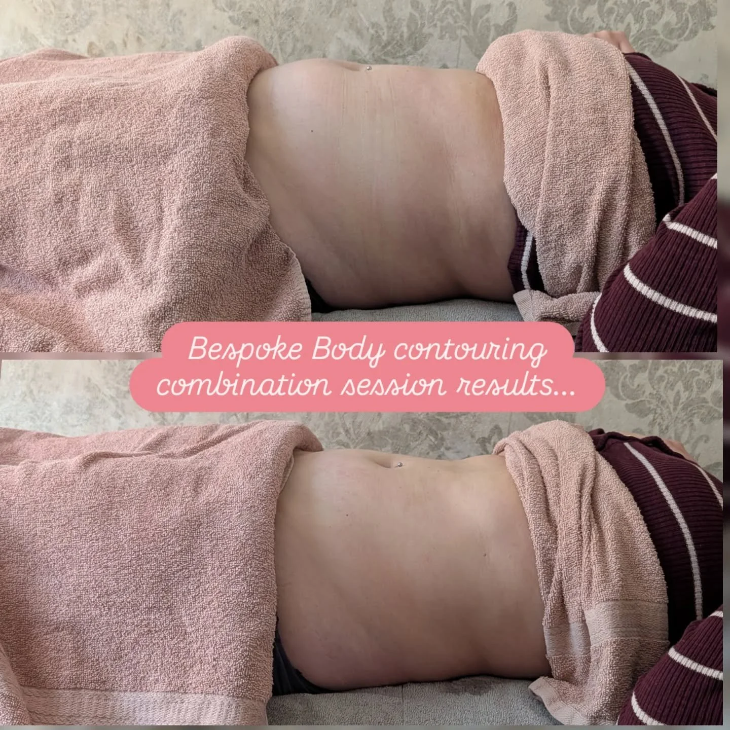 Bespoke treatment for my client today 😍👀
One session results 😲