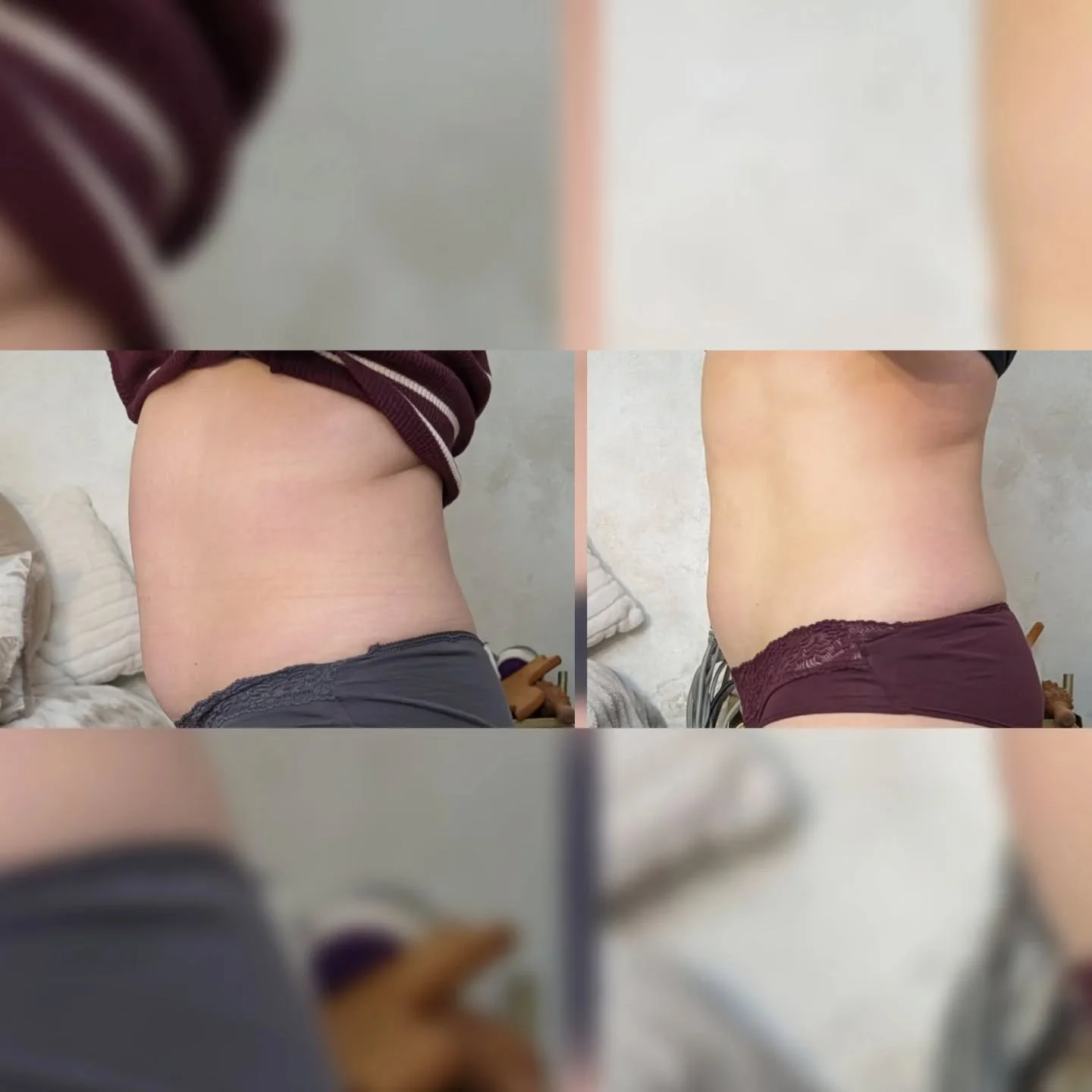 ✨ Client Results Update ✨
Already seeing amazing changes after just a couple of sessions 👏
We started with the Vacuslim wrap &mdash; the perfect detox treatment to kickstart results 💧

This helps:
✔️ Flush excess fluid &amp; toxins
✔️ Reduce bloati