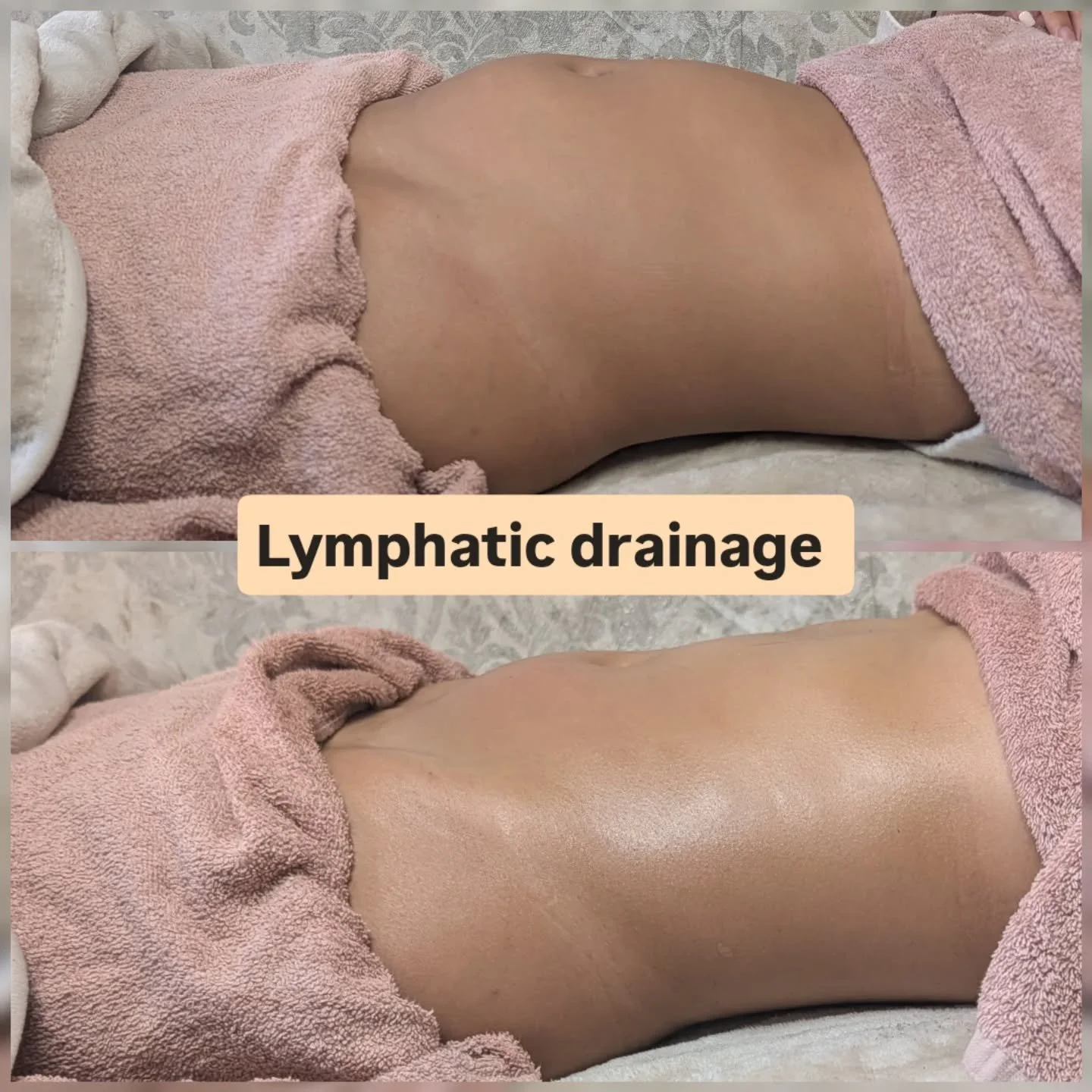 What a nice end to the day .....

Lymphatic drainage massage result 😍

This is now on offer on my  booksy 😯😁
Link on the bio ☝️