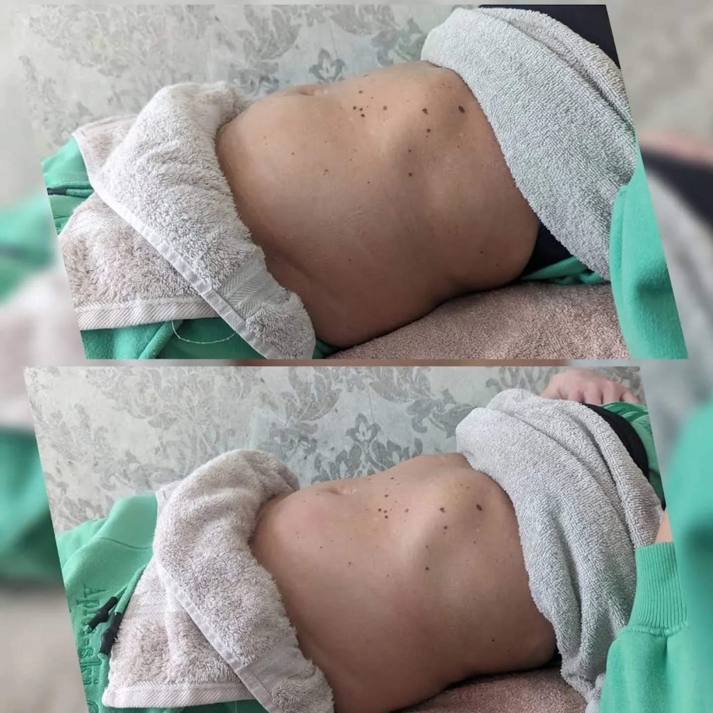 🔥 REAL RESULTS &ndash; NO FILTERS 🔥

Stubborn belly not shifting no matter what you try?

✨ BEFORE ➡️ AFTER

Visible difference after targeted body contouring treatments

This isn&rsquo;t just &ldquo;weight loss&rdquo;&hellip;
This is breaking down