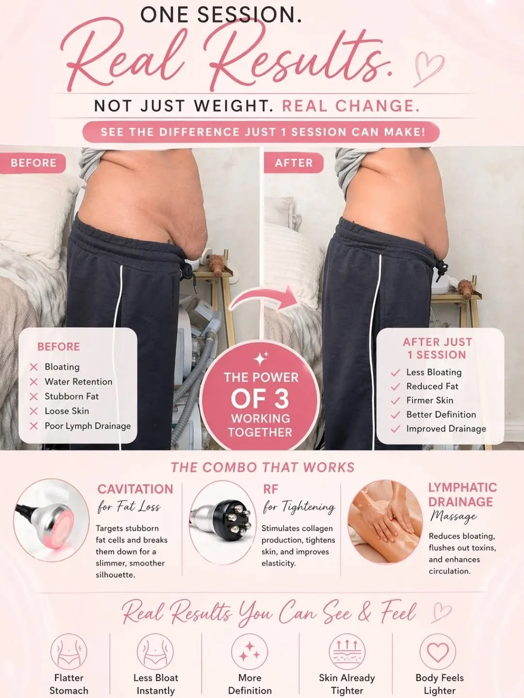 ✨ NOT JUST FAT&hellip; THIS IS BLOAT + LYMPH TOO ✨

This is what ONE session can do when you treat the body properly 👇

💥 It&rsquo;s not always fat&hellip;
A lot of what you&rsquo;re holding is:
❌ Bloating
❌ Water retention
❌ Sluggish lymphatic sys