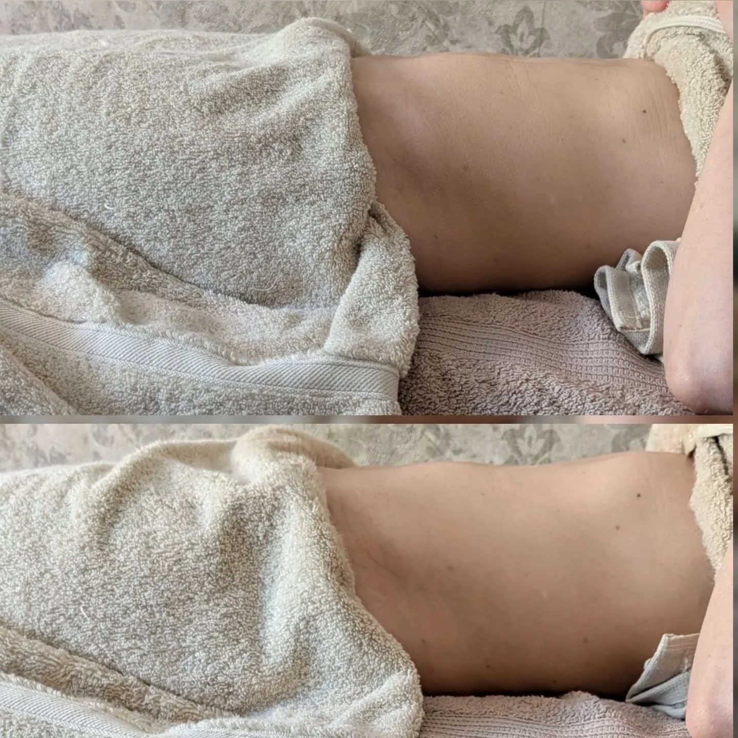 ✨ Let's talk Histamine for a second ....
our body can&rsquo;t clear what it can&rsquo;t drain&hellip; ✨

When the lymphatic system becomes sluggish, the body may struggle to clear excess fluid and waste efficiently &mdash; leaving you feeling puffy, 