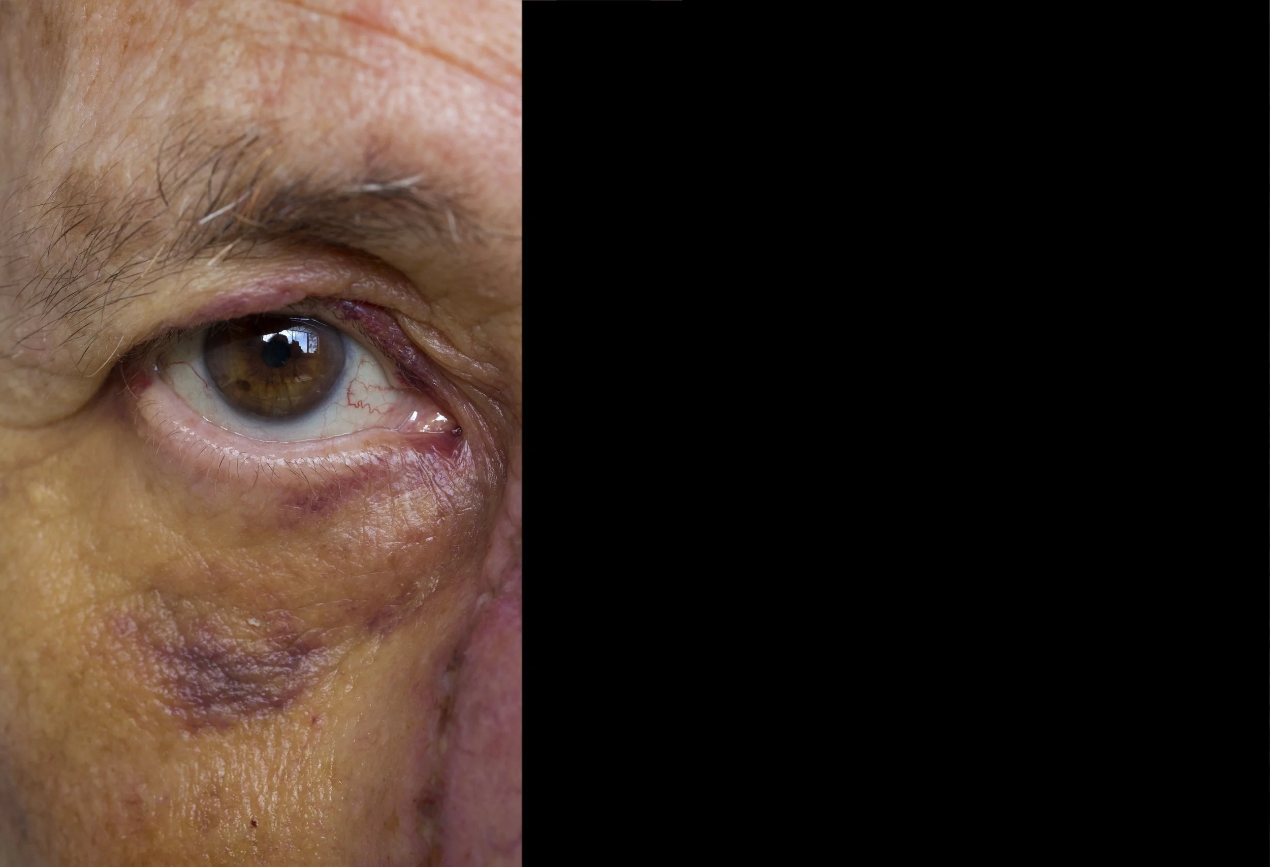 Mad Love-A Flame in Your Heart, 6.86" x 10", ©2015