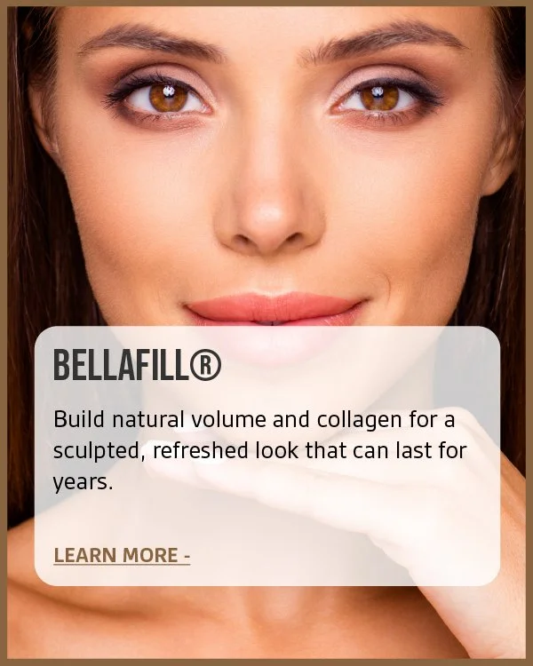 Close-up of a woman with brown eyes and makeup, smiling softly, with a promotional overlay for BELLA FILL skincare product about building natural volume and collagen.
