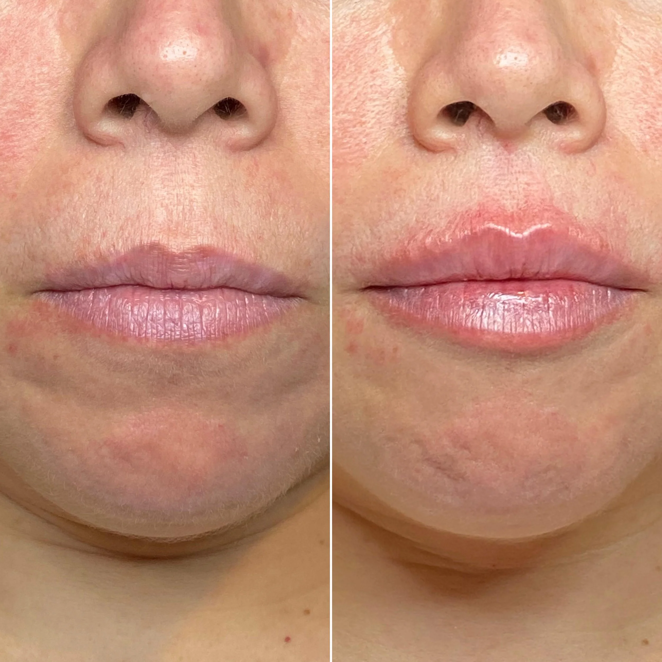Comparison of lips before and after applying lip gloss or treatment, showing increased shine and fullness.