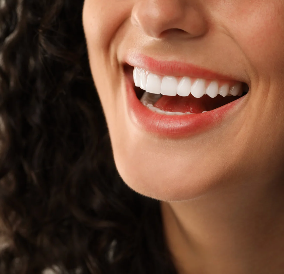 Porcelain Veneers | Cape Town