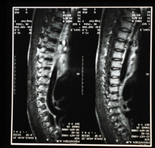 spine imaging