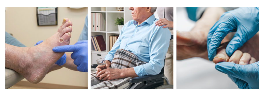 Close-up of a foot exam by medical professional with gloves, an elderly man in a wheelchair holding a glass of water in a medical office, and a healthcare worker examining a patient's hand with gloves.
