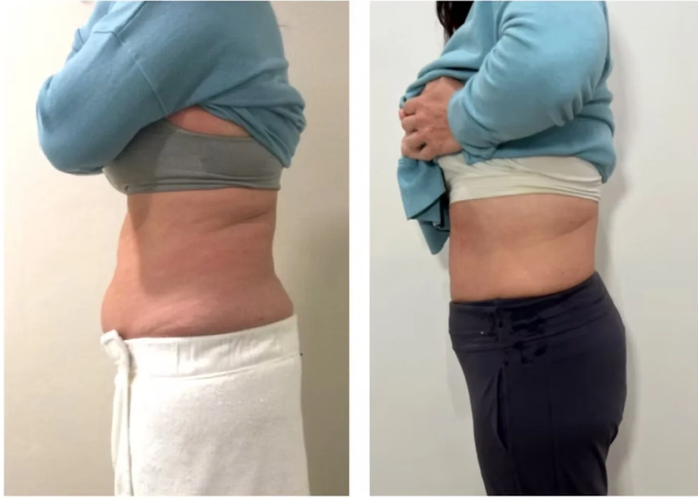 TruSolace_Before and After (2).jpg