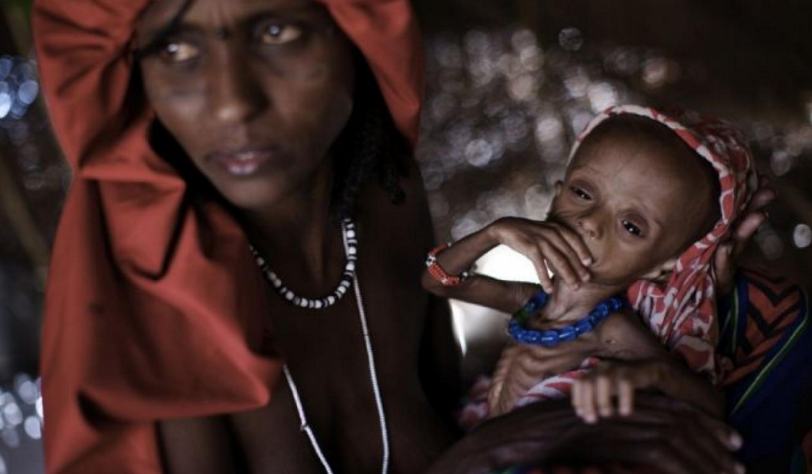 Healing the world: Ethiopia