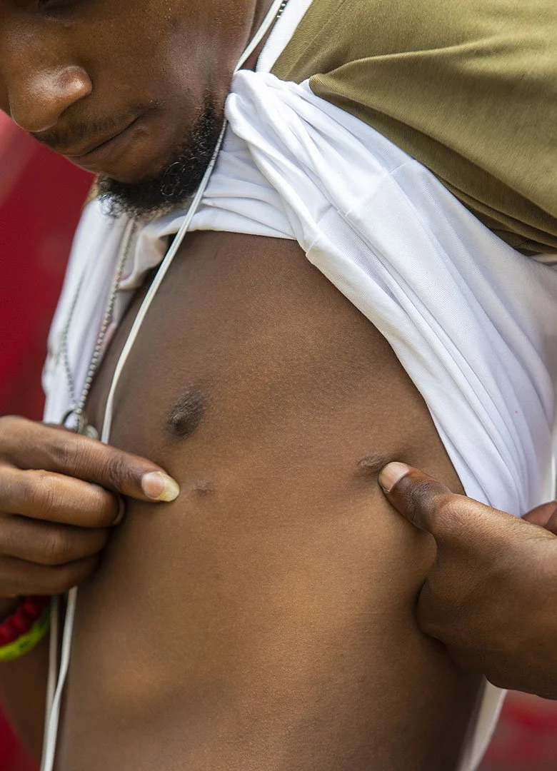  Lee Eric Evans shows his entry and exit gunshot wounds while at his aunt’s home on Davis Street in Jackson, Miss. Tuesday, July 3, 2018. (Photo by Eric J. Shelton/GroundTruth) 