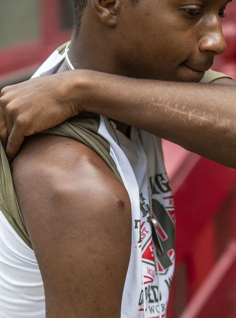  Lee Eric Evans shows his gunshot wounds after explaining the several occurrences of gun battles that he was involved in while living in Jackson, Miss. July 3, 2018. (Photo by Eric J. Shelton/GroundTruth) 