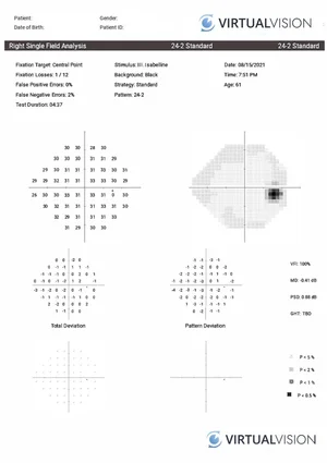 Virtual Vision Virtual Eye VR Headset Visual Field Testing — Culey ...