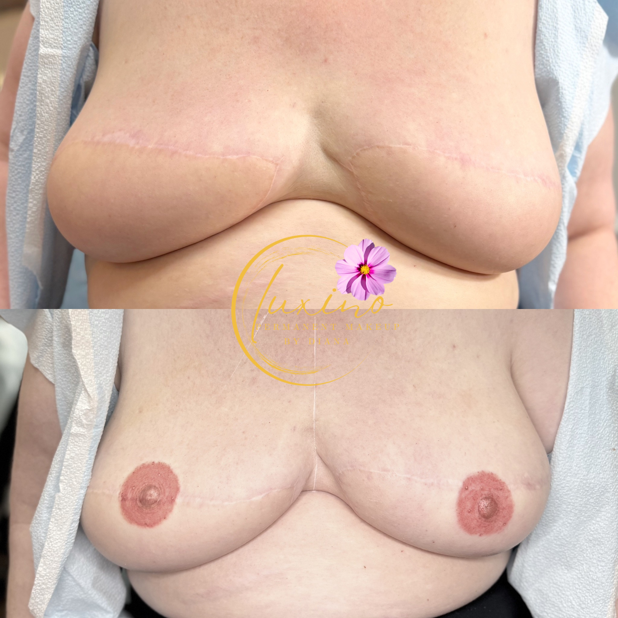 3D Nipple Areola Tattoo