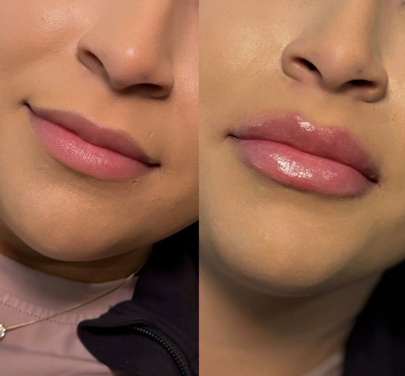 Close-up of a woman's face showing her lips before and after applying lip gloss, with the left side showing natural lips and the right side showing shiny, glossy lips.
