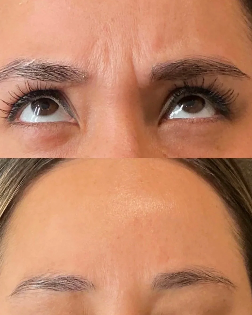 A close-up photo showing a person's eyes looking upward with eye makeup, and the person's smooth forehead below.