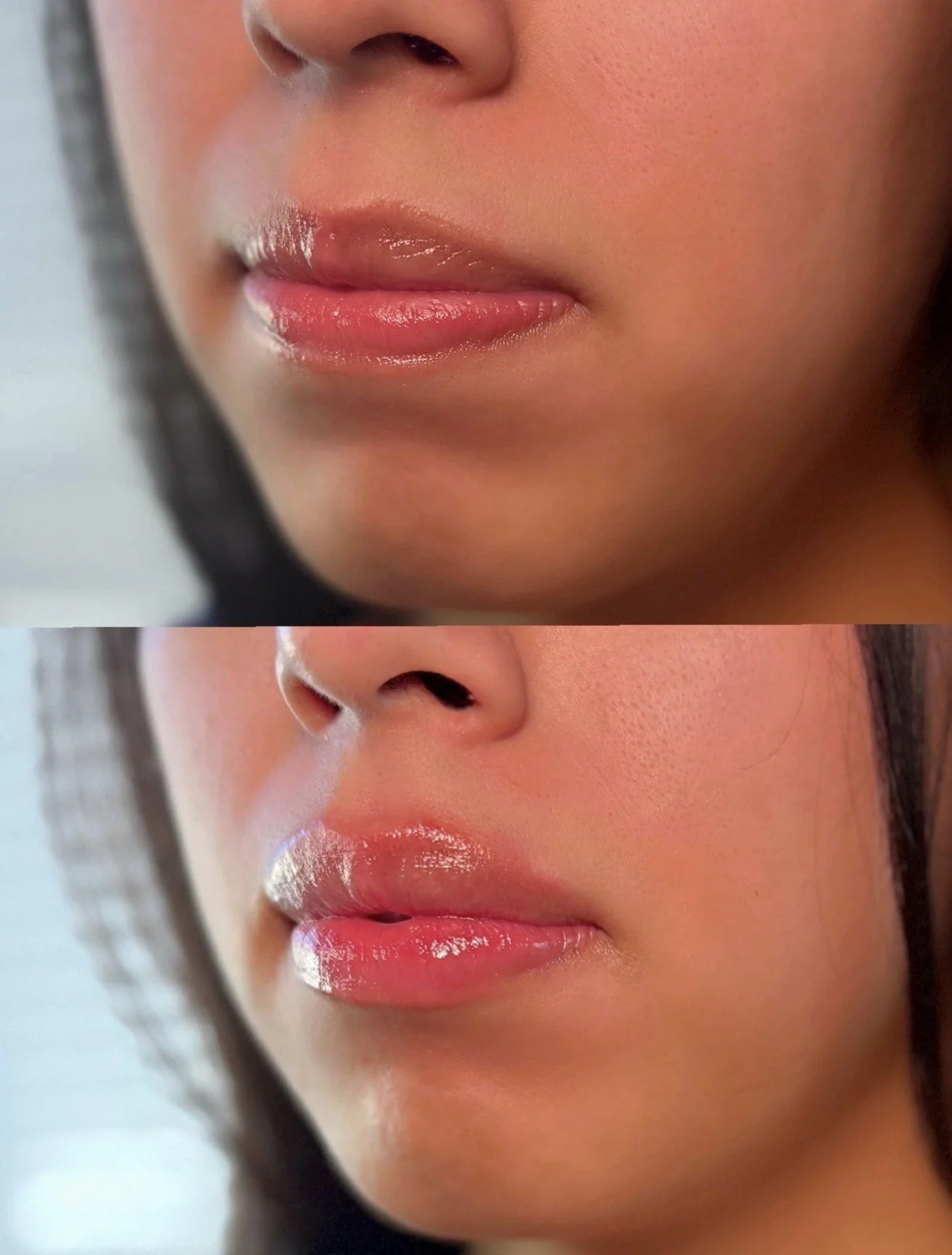 Close-up of a woman's lips, showing them in a natural and glossy state, with a focus on the lower half of her face.