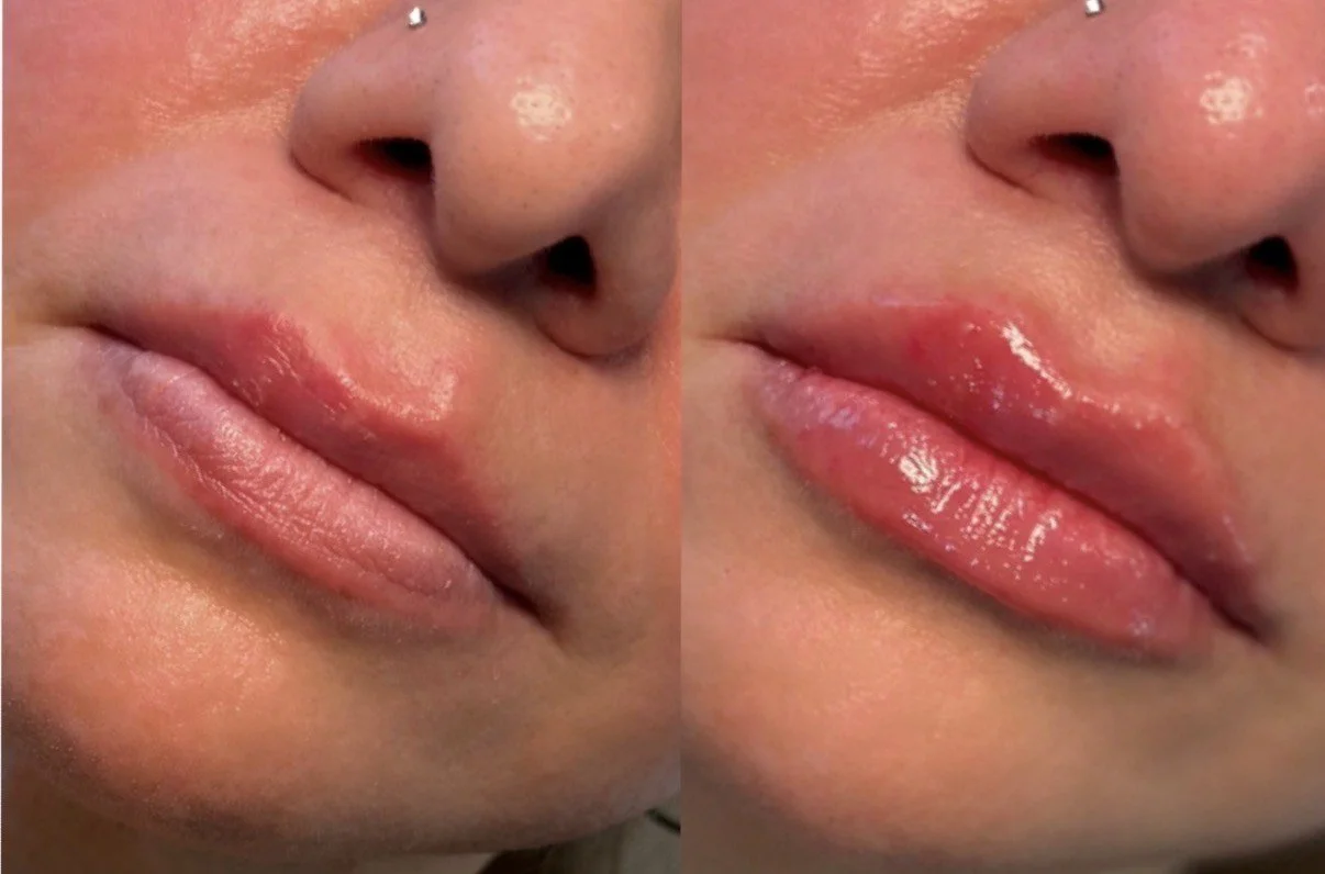 Close-up of lips showing a before and after comparison of lip gloss application, with the lips appearing more glossy and moisturized in the after image.